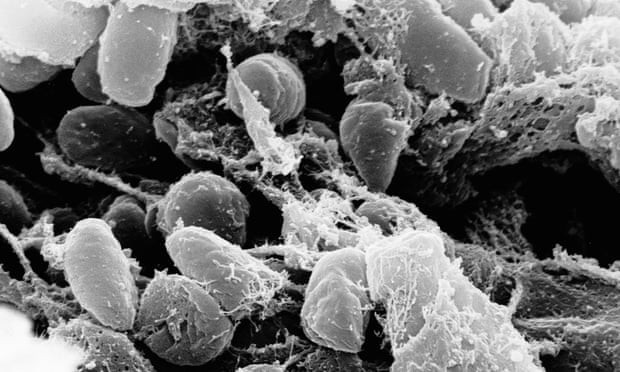 Vi khuẩn Yersinia pestis gây bệnh dịch hạch. Ảnh: AP.