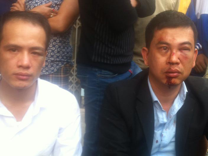 Luật sư Luân (trái) luật sư Nam (phải) bị hành hung tại Chương Mỹ.