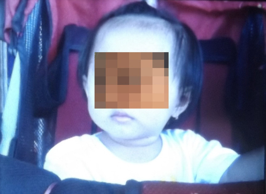 Bé T. vừa được các bác sĩ gắp ra một viên đá bằng đầu đũa nằm mắc kẹt trong mũi. Ảnh: Thanh Lâm