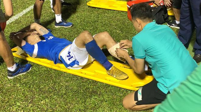 Dính chấn thương kinh hoàng, ngôi sao Quảng Ninh phải nghỉ 3 tháng