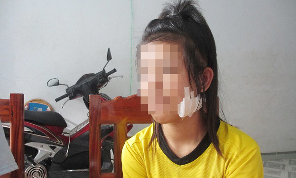 Nạn nhân Huỳnh Nhi kể lại sự việc