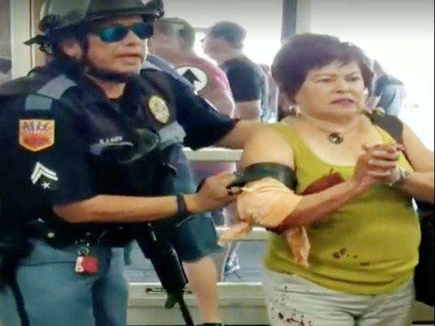 Một nạn nhân bị thương được băng bó. Ảnh: The Sun