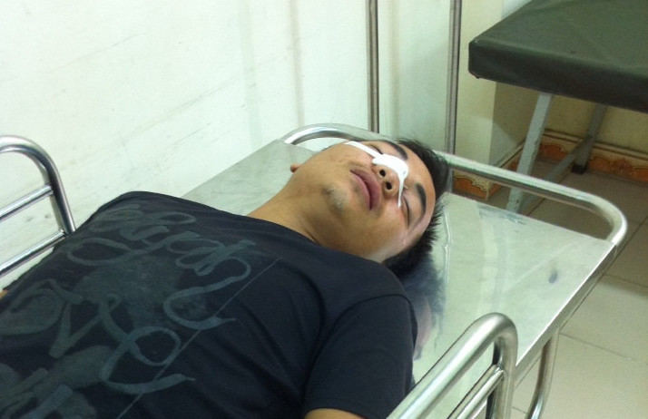 Tài xế xe bồn nằm tại bệnh viện sau cú chém đứt sống mũi. Ảnh: Đại Đức