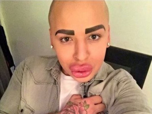 Chàng trai chi hơn 3 tỷ đồng phẫu thuật mặt giống cô Kim