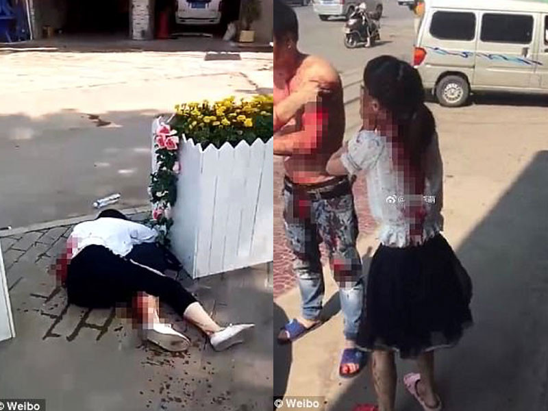 Những người bị thương trong vụ tấn công bằng dao ở Tây An. Ảnh: Weibo