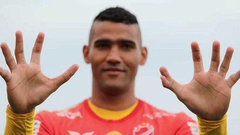 Thủ môn Brazil sở hữu bàn tay lạ kỳ có... 6 ngón