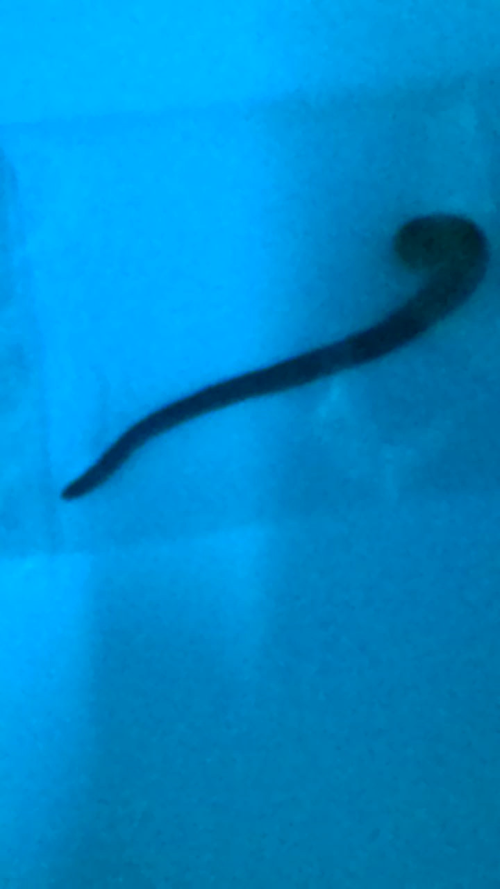 Con vắt đã được bắt ra ngoài