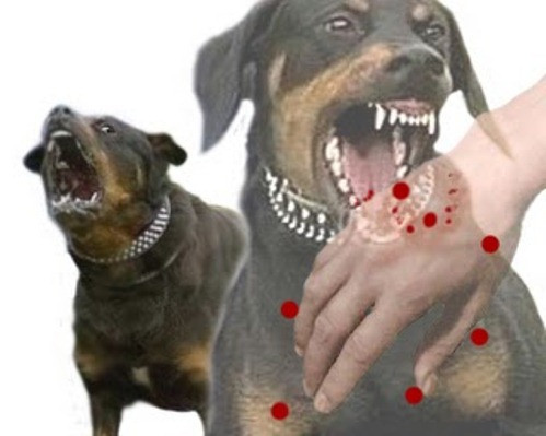 Các bác sĩ khuyến cáo cộng đồng cần chủ động các biện pháp bảo vệ bản thân, gia đình để tránh nguy cơ mắc bệnh dại