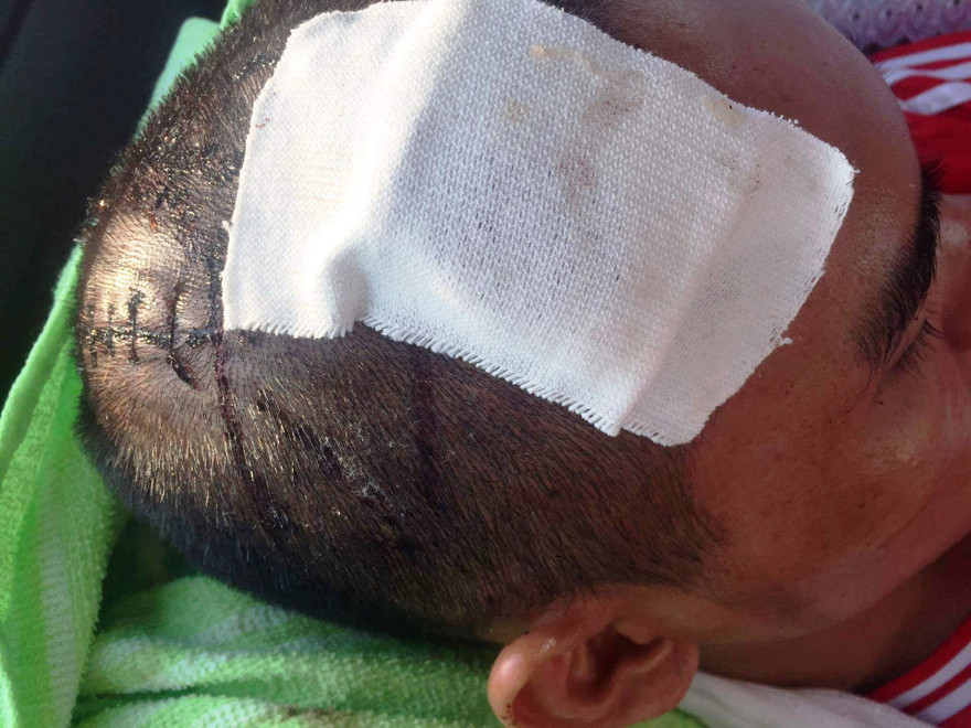 Ông Thái Thiện Nhân bị truy sát với nhiều vết thương trên đầu