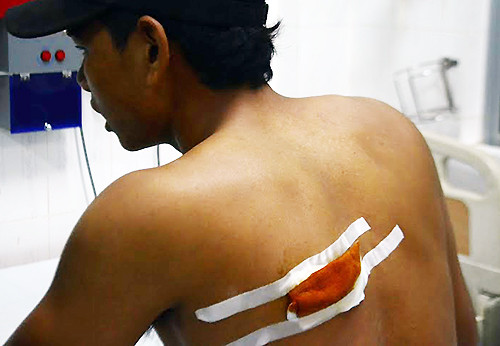 Một trong 15 người bị thương đang được điều trị tại bệnh viện. Ảnh: Thiện Nhân/VnExpress