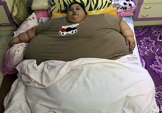 Iman Ahmad Abdulati hiện nặng tới 500kg.