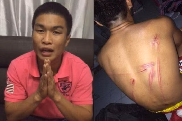 Bức ảnh Nattawut tung lên mạng làm bằng chứng tố cáo bị HLV đánh đập
