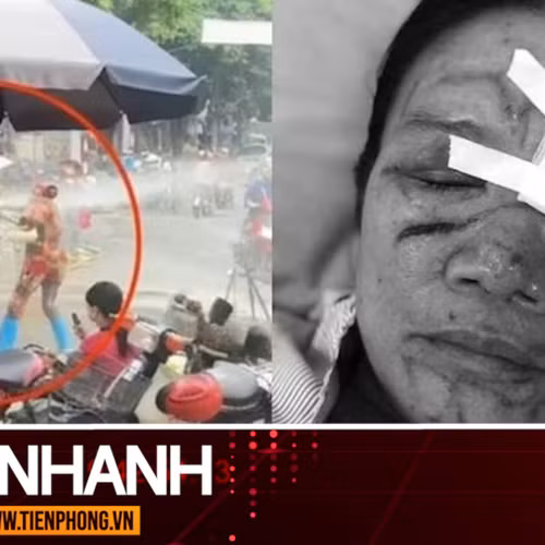 TIN NHANH: Liên tiếp xảy ra vụ xịt vòi nước cao áp vào người khác, luật sư nói gì?