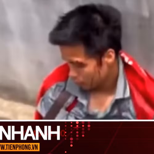 TIN NHANH: Xác minh vụ shipper bị sư thầy đánh chảy máu đầu