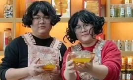 Cặp vợ chồng giống nhau như 2 giọt nước, cộng đồng mạng đến tận nơi 'xem' 