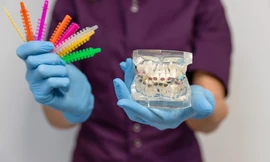 Những lợi ích sức khỏe của việc niềng răng thưa