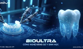 Đột phá công nghệ răng sứ y sinh học không mài nhỏ tại nha khoa Smilux