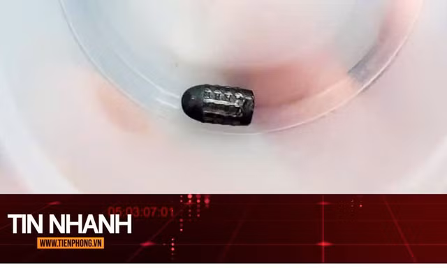 TIN NHANH: Hy hữu người phụ nữ sống sót dù bị đạn lạc găm trúng đầu