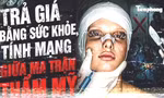 'Mũi 6D', 'mắt giọt lệ' và cái giá đau đớn 