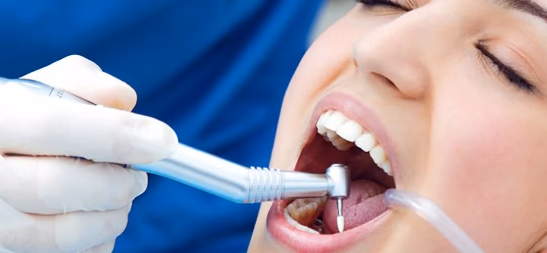 checkup-dentist-tool-instrument-young-1301-3124-1-1.jpg