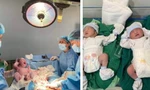 Truy tìm 'bác sĩ Khoa' - người viết facebook 'rút ống thở của mẹ để cứu sản phụ sắp sinh'