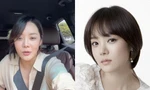 Chae Rim lộ gương mặt cứng đơ, còn đâu nữ thần ngọt ngào khiến fan một thời thương nhớ
