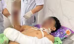 Mất mạng, cụt tay chân, mù mắt...vì pháo