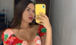 Hoa hậu 24 tuổi người Venezuela qua đời