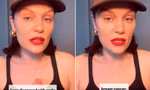Jessie J thông báo mắc ung thư vú giai đoạn đầu, sẽ tạm nghỉ hát để chữa trị