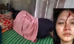 Nhiều vụ học sinh đánh nhau, ngành giáo dục ‘chẩn bệnh’ bạo lực học đường