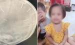 Bé 3 tuổi bị đóng đinh vào đầu vẫn nguy kịch, có thể được truyền máu từ bố