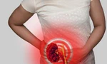 Những dấu hiệu cho thấy thận của bạn đang ‘kêu cứu’, đi khám ngay kẻo muộn