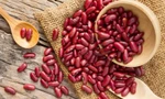 Ăn đậu đỏ rất tốt nhưng cần nhớ kỹ những lưu ý này khi ăn để tránh 'rước bệnh vào thân'