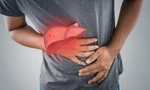 Ngủ dậy thấy những dấu hiệu này nên đi khám gan ngay kẻo 'hết đường cứu'