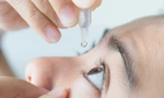 Sai lầm khi sử dụng thuốc nhỏ mắt có thể khiến bạn mù lòa