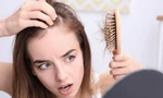 Những thói quen không thể ngờ khiến tóc rụng 'nhiều không đếm xuể’