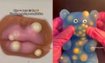 Thỏa mãn cơn ghiền với món đồ chơi lấy nhân mụn đang gây sốt mạng xã hội