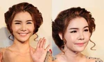 Người mẫu Kỳ Hân - vợ Mạc Hồng Quân - khủng hoảng vì khuôn mặt biến dạng do phẫu thuật thẩm mỹ