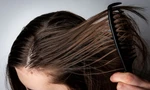 Tóc dầu có nên gội đầu hàng ngày hay không? 