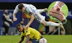 Messi bị đối thủ "chém" tung người và hệ quả là chân chảy máu