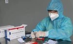 Bác sĩ kể chuyện 'truy tìm' chủng virus Delta ở TPHCM 