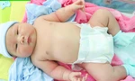 Bé trai chào đời có cân nặng 'khủng' ở Bình Phước