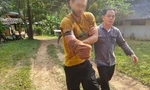 Stefan Specogna với vết thương trên tay sau khi bị gấu đen cắn. (Ảnh: ST)