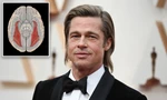 Showbiz 7/7: Nguy hiểm từ hội chứng mù mặt của Brad Pitt
