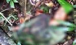 Nạn nhân bị trúng 13 mảnh đạn ria vào vùng tay và ngực làm thủng phổi dẫn đến tử vong. Ảnh: Q.T