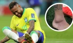 Brazil 'lo sốt vó' với chấn thương của Neymar