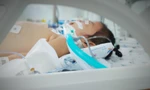 Bé gái nhập viện trong tình trạng nguy kịch phải hỗ trợ thở máy, điều trị tích cực