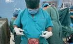 Đắp lá điều trị, người phụ nữ mang khối ung thư đến 30 cm ở 'vùng kín' 