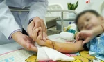 Đi bộ trên đường, bé 5 tuổi bị xe máy gây tai nạn đứt lìa bàn tay