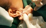Nữ bệnh nhân bị dị dạng 'tai voi' vì sai lầm nhiều người hay mắc phải
